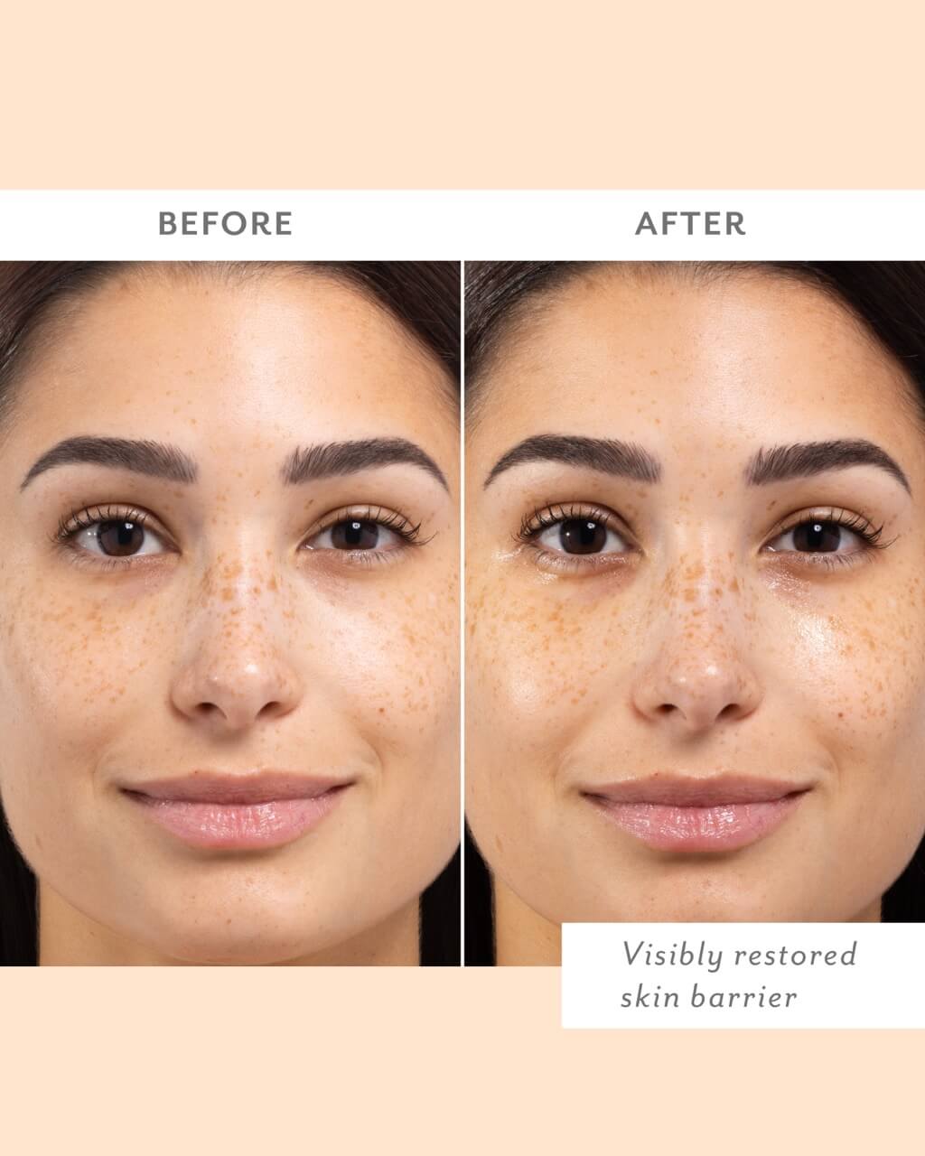 Skin Remedy Mask