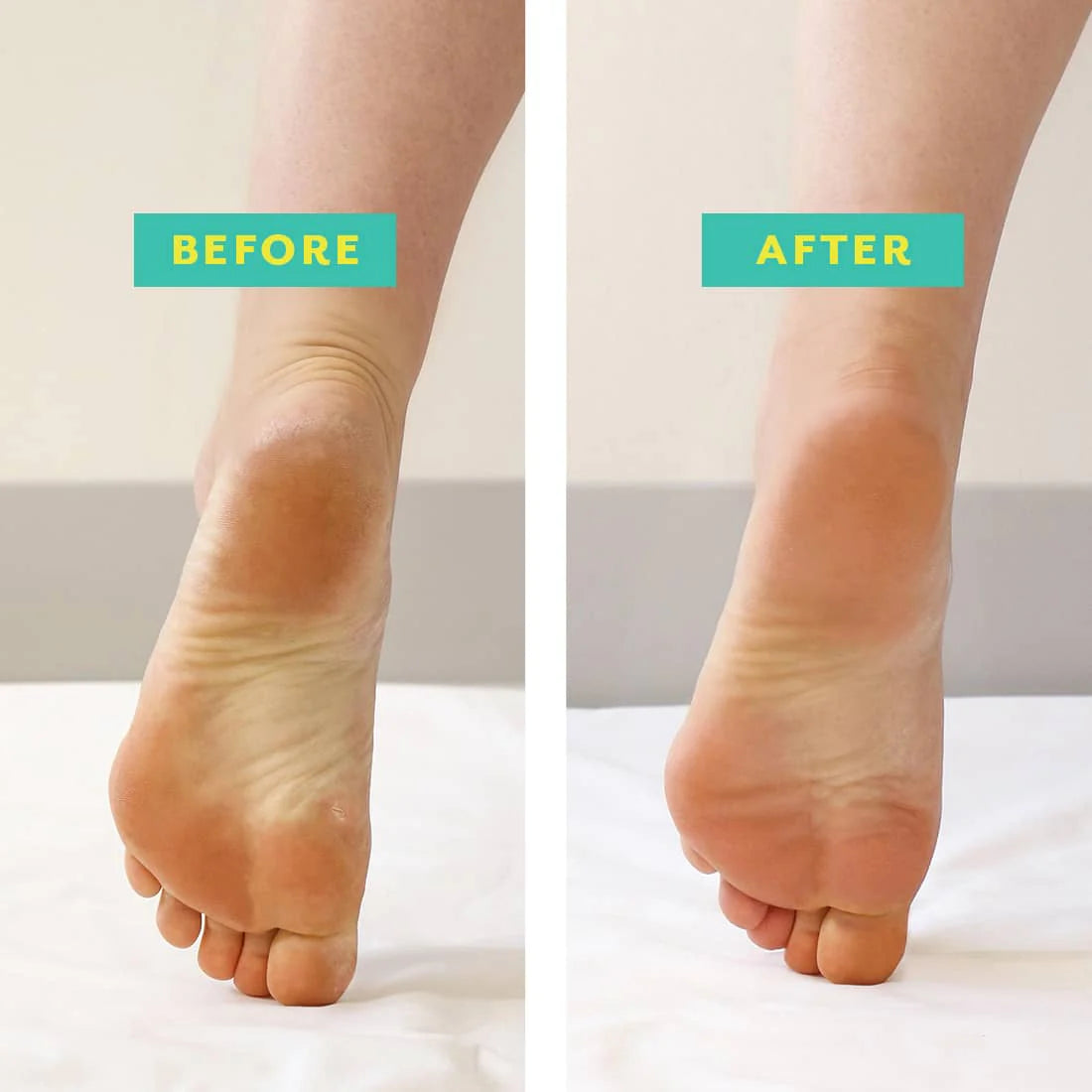 PoshPeel™ Pedi Cure